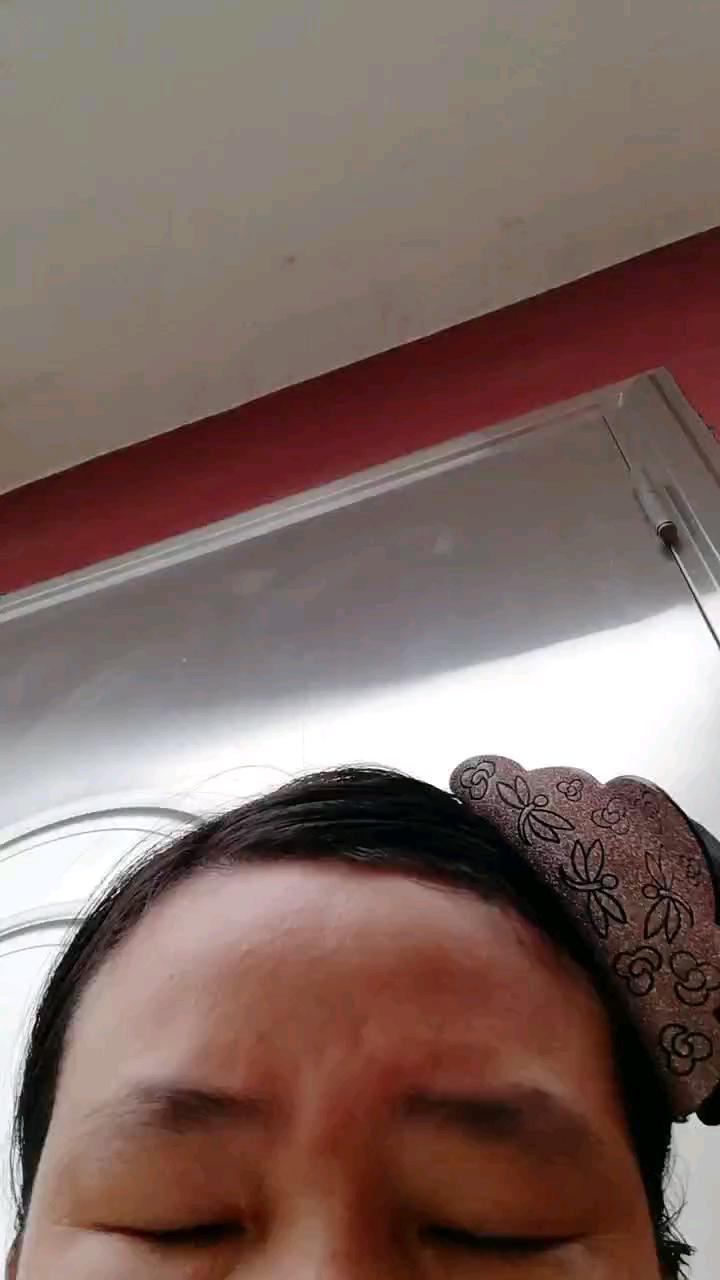 2021年3月1号汤院长做的眉心疤痕切缝