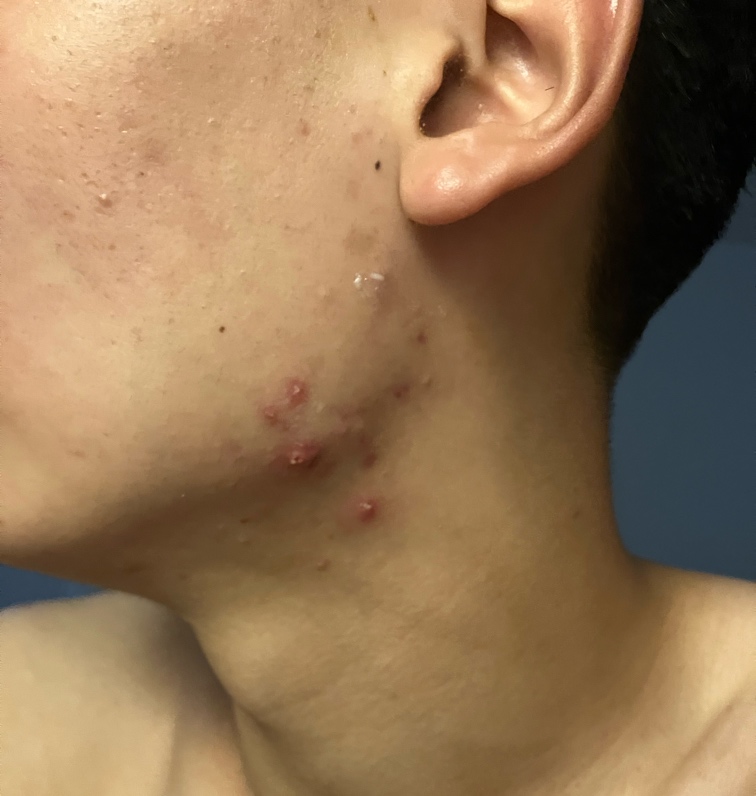 请问这种情况该怎么处置 