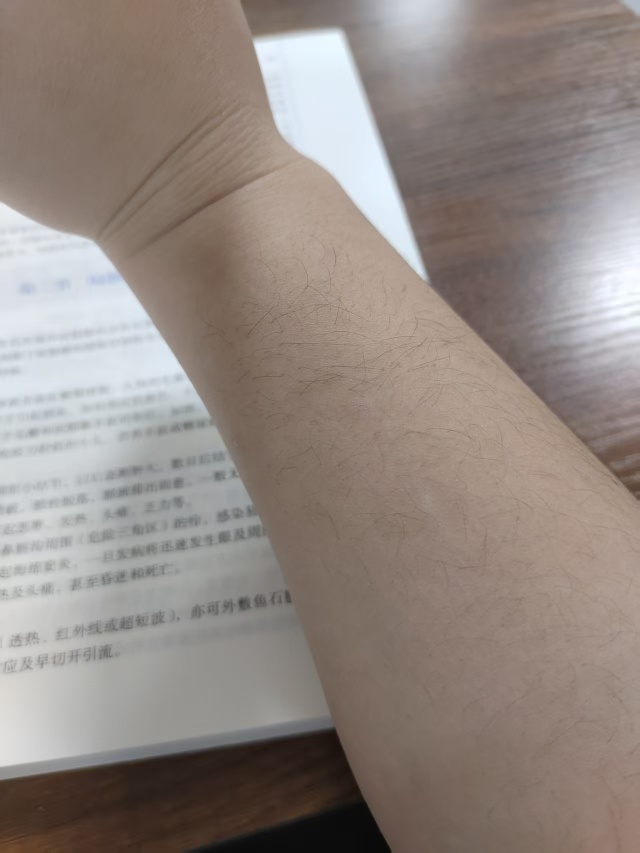 请问我这个还可以好吗？ 