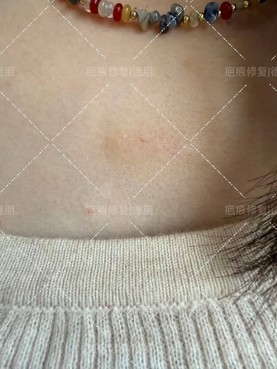 经过专业的3个月修复，完美收工 
