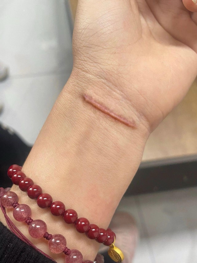 当我用中药涂抹了三个月以后，恢复 