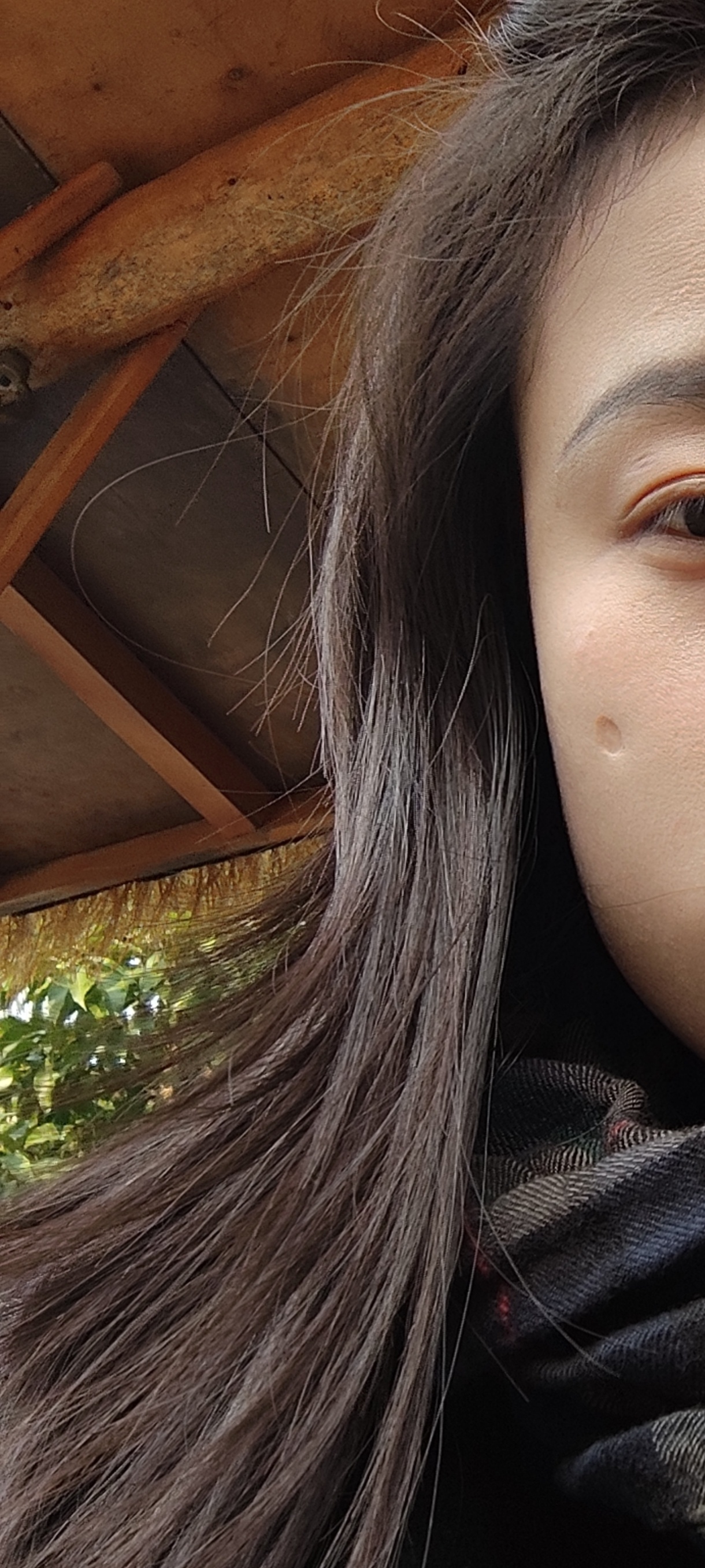 这种凹坑修复难度大吗？是小时候血 