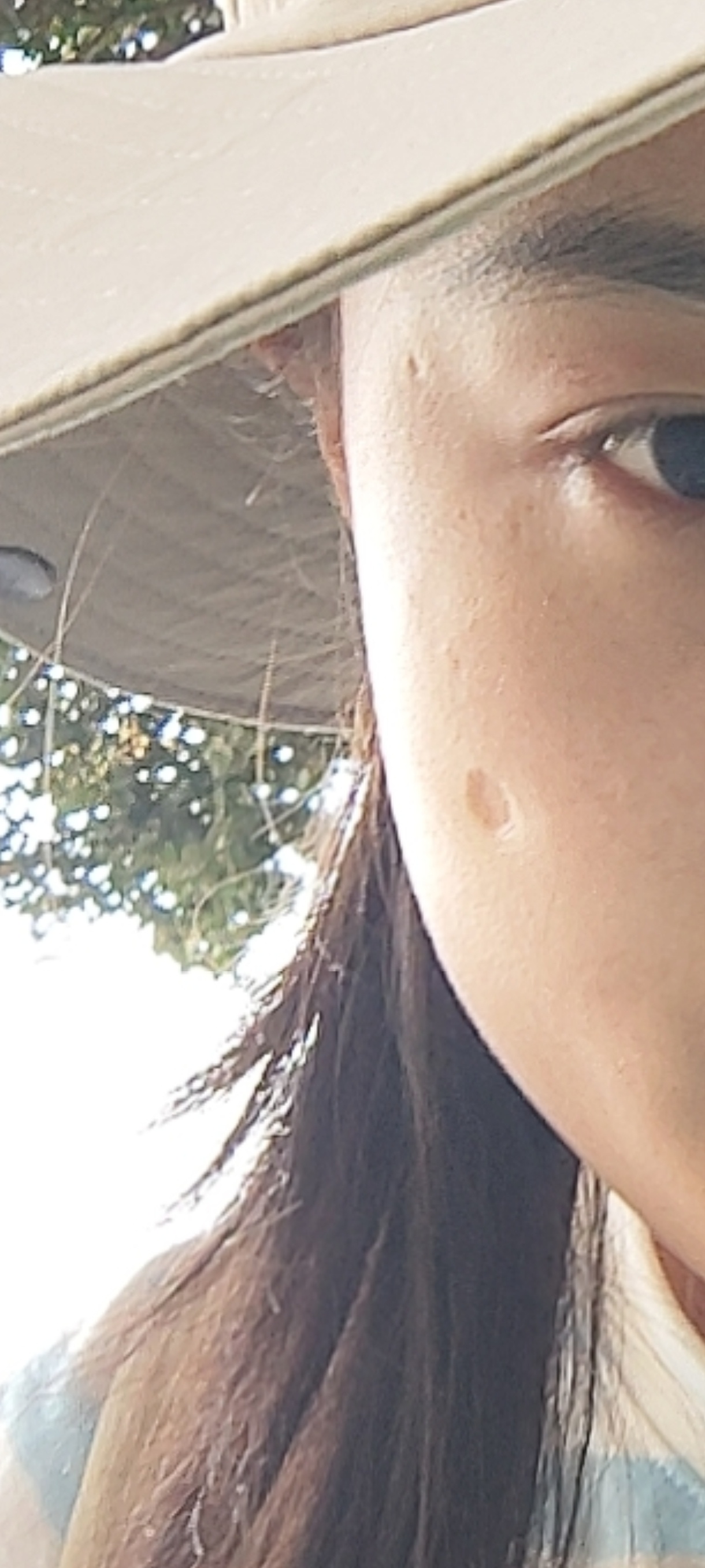 这种凹坑修复难度大吗？是小时候血 